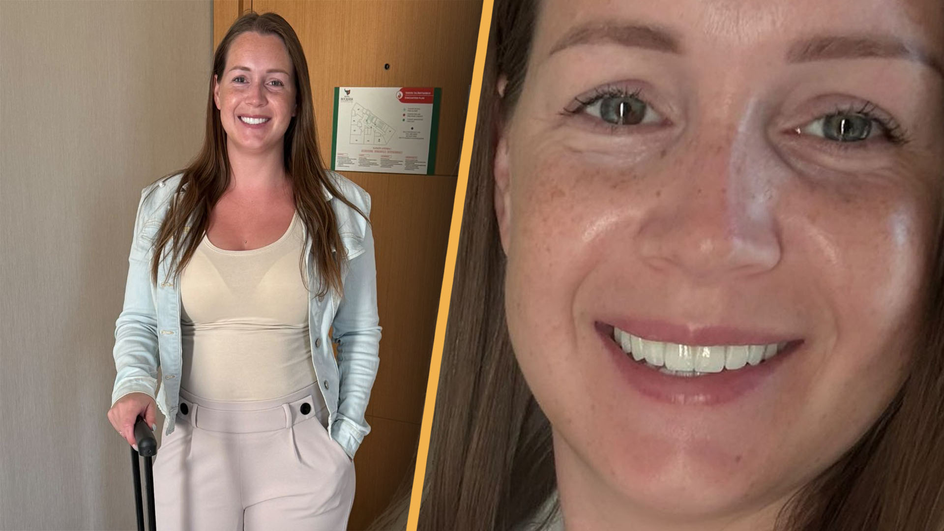 Patiënt Jana Mercy met Eshetic-Airlines in Istanbul in Turkije