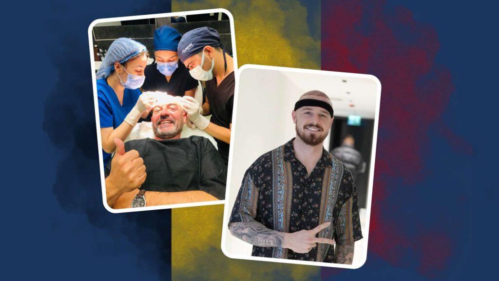 Haartransplantatie in België met Esthetic-Airlines